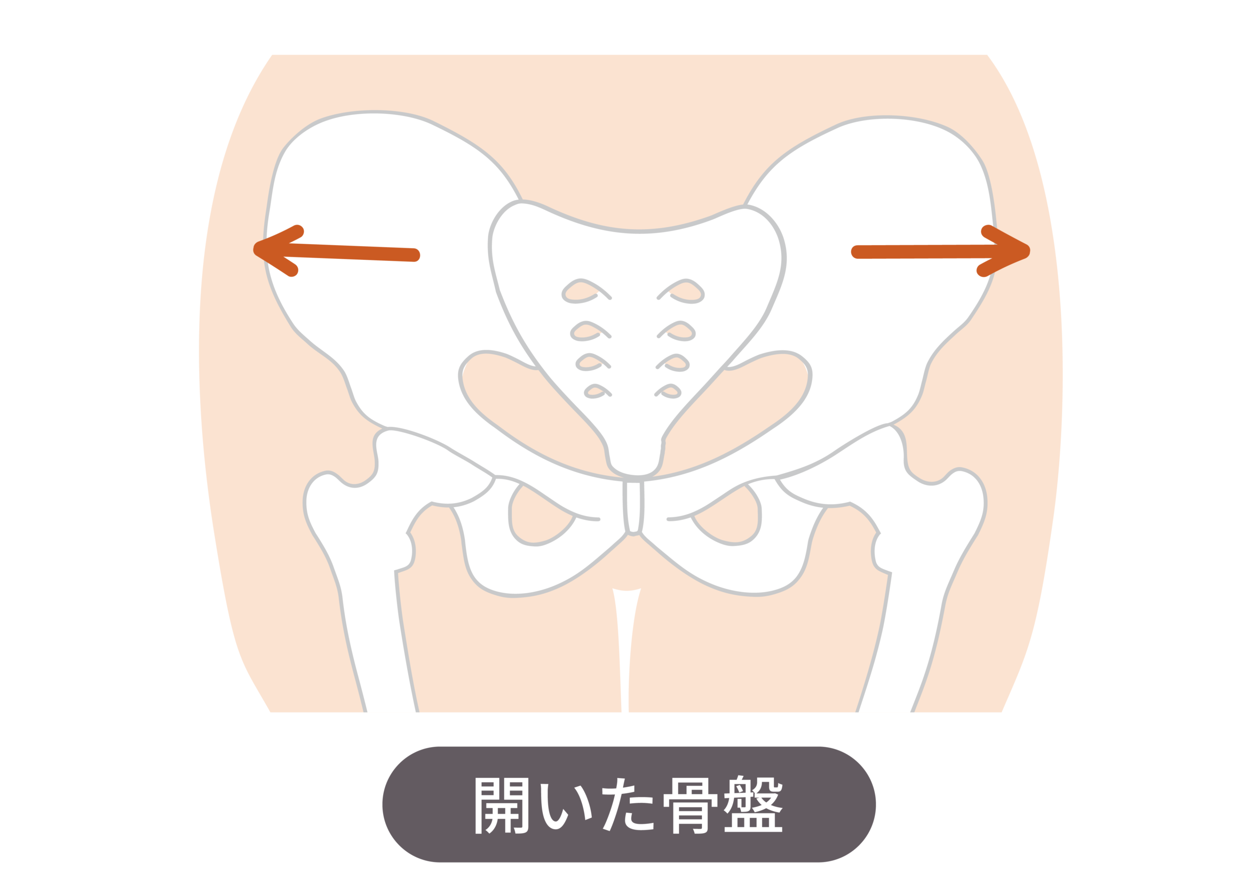 開いた骨盤のイメージ図｜産後の骨盤の変化